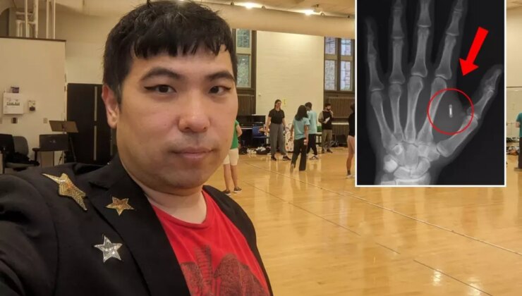 Akılalmaz hata! Eline yerleştirdiği mikroçipin şifresini unuttu