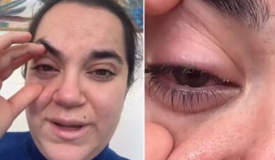 Bulaşık makinesi tableti kadının gözüne patladı, kör olma korkusu yaşadı