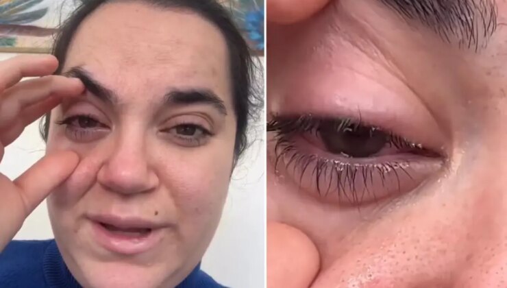 Bulaşık makinesi tableti kadının gözüne patladı, kör olma korkusu yaşadı