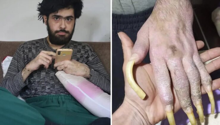 Türkiye’nin konuştuğu Barış’ın yeni işini ve son halini görenler şaşıp kalıyor